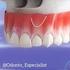 Análisis de cierre apical del tercer molar para determinación de edad dental y cronológica