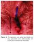 ÚLCERAS CUTÁNEAS Concepto fístulas fisura afta úlceras cutáneas de origen vascular venosas (de estasis) arteriales