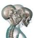 Abordaje en Medicina Física y Rehabilitación del dolor crónico: DOLOR CERVICAL