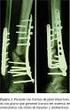Importancia de la osteosíntesis biológica en el tratamiento de las fracturas del esqueleto apendicular del perro