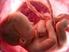Transferencia selectiva de un único embrión como prevención del embarazo múltiple