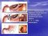 Frecuencia y características morfológicas de la estenosis de uretra anterior por sonouretrografía