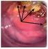 Recidiva de lesión intraepitelial cervical en pacientes postresección de cono con asa diatérmica