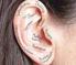 Hearing Loss. Causes. Signs