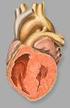 Cierre del Ductus Arterioso Persistente por Cateterismo