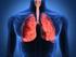 Enfermedad obstructiva crónica (EPOC): hábito tabáquico y sintomatología respiratoria asociada