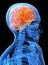 Mal de Parkinson: Las enfermedades neurodegenerativas se caracterizan