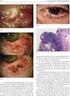 Tumores de la glándula tiroides Dr. Julio Lambea Sorrosal