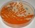 BD Group B Streptococcus Differential Agar (Granada Medium)