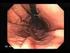 Endoscopías digestivas altas y biopsias gástricas en la Clínica Médica Cayetano Heredia.