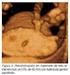 Con el advenimiento del ultrasonido prenatal en