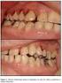 Hemorragias dentales por patologías sistémicas