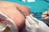 Curso de suturas manuales y asistencia a la reparación del periné