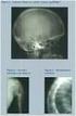 Alteraciones focales de la señal de la médula ósea de los cuerpos vertebrales: Hallazgos en RM y diagnóstico diferencial.