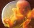 Estatuto del embrión humano