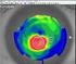 Topógrafos corneales. Sirven para adaptar lentillas?