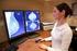Programa de Detección Precoz de Cáncer de Mama. Evaluación de Resultados CASTILLA-LA MANCHA 2014