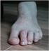 Los pies son grandes y con las garras moderadamente curvadas, el dedo posterior es débil y más elevado que el resto de los dedos.