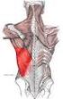 6.- En relación al musculo dorsal ancho señale la opción correcta a) Es intrínseco del tronco b) Es superficial c) Es autoctono del dorso d) Todo es