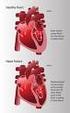 Heart Failure Designing Systems for Effective Heart Failure Care