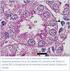 Daño por isquemia-reperfusión renal: Rol del Estrés oxidativo