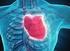 Arritmias cardiacas que se pueden manifestar como síncope convulsivo Dr. Gerardo Pozas Garza