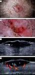 Correlación ultrasonográfica e histopatológica de los tumores de ovario