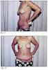 Implantes de mama; esos grandes desconocidos para el radiólogo.