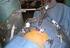 Estado actual de la cirugía laparoscópica esofágica The present state of esophageal laparoscopic surgery