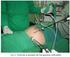 Hernioplastia inguinal laparoscópica totalmente extraperitoneal: resultados a 1-3 años (170 hernias)