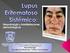 Astenia en el Lupus Eritematoso Sistémico