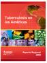 Tuberculosis en las Américas