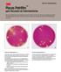 Placas Petrifilm. para Recuento de Enterobacterias. Guía de interpretación