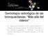 Semiología radiológica de las bronquiectasias: Más allá del clásico