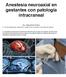 Anestesia neuroaxial en gestantes con patología intracraneal