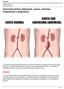 Aneurisma aórtico abdominal: causas. síntomas, tratamientos y diagnóstico